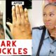 Scars And Stretch Marks Removal Cream In Kampos Village In Cyprus Call +27710732372
